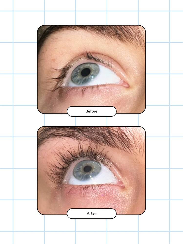 Xlash - Eyelash Serum, 5ml (Wholesale 3 pack, RRP $120 Each)