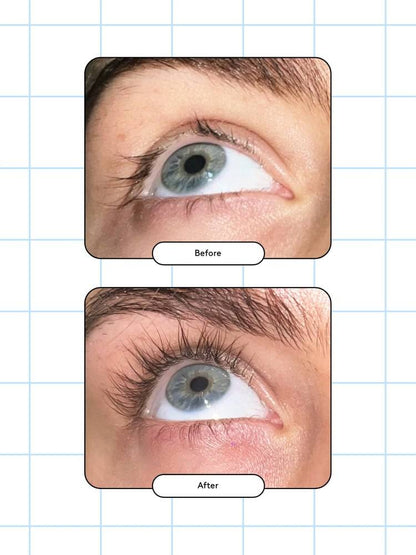 Xlash - Eyelash Serum, 5ml (Wholesale 3 pack, RRP $120 Each)