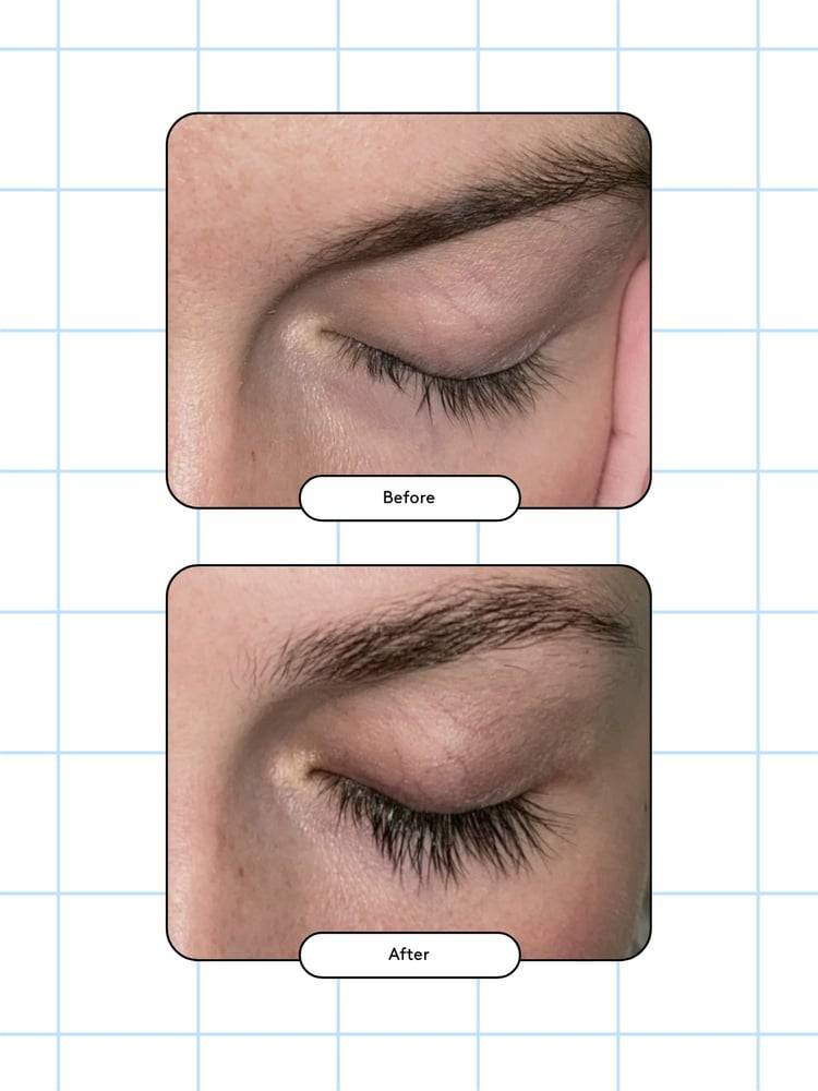 XLASH - Eyelash Serum (Available in 3ml or 5ml)